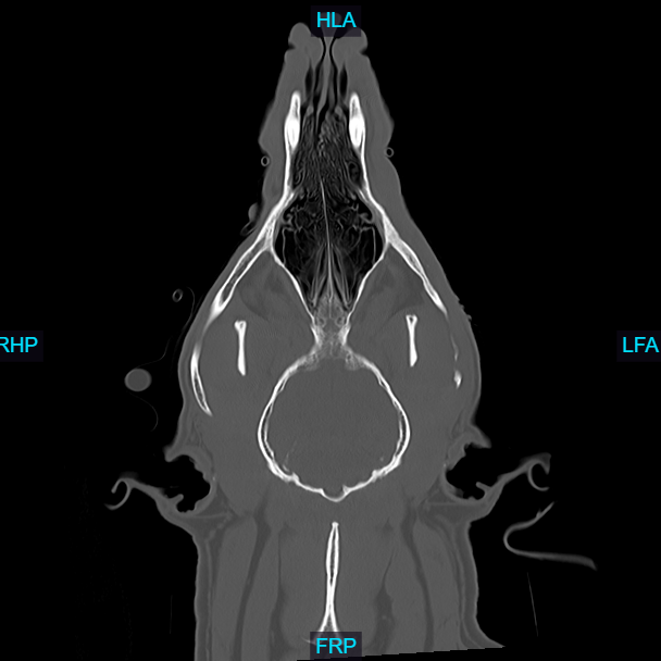 ct scan ct scan