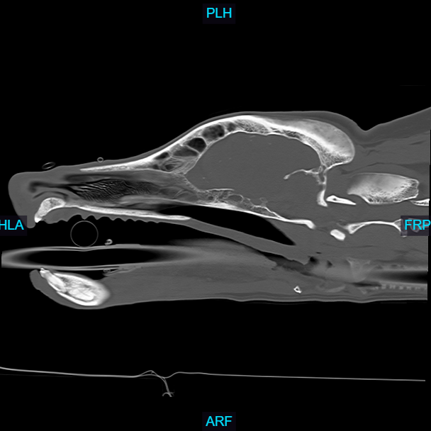 ct skull 2 ct skull 2